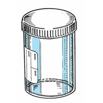 Mintavevő vizeletpohár, 200 ml, csavaros kupakkal, címkés Mintavevő vizeletpohár, 200 ml, csavaros kupakkal, címkés
