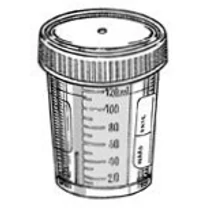 Vizelet mintavevő, 120 ml, osztott, csavaros kupakkal, címkés