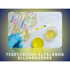 Vizelettesztek általános ellenőrzésre Vizelettesztek általános ellenőrzésre