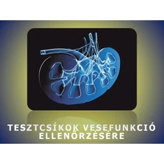 Vizelettesztek vesefunkció ellenőrzésére Vizelettesztek vesefunkció ellenőrzésére