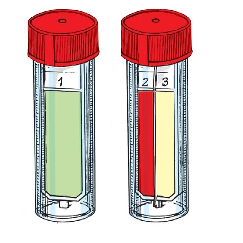 CLED / MacConkey / Cetrimide agar